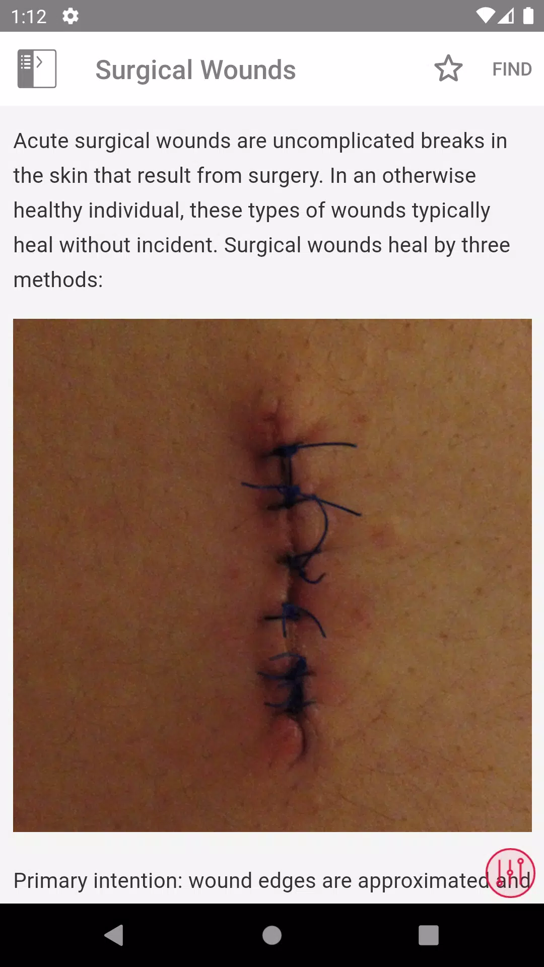 Wound Care MI Visual應用截圖第3張