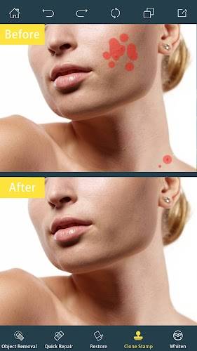 Photo Retouch- Object Removal স্ক্রিনশট 1