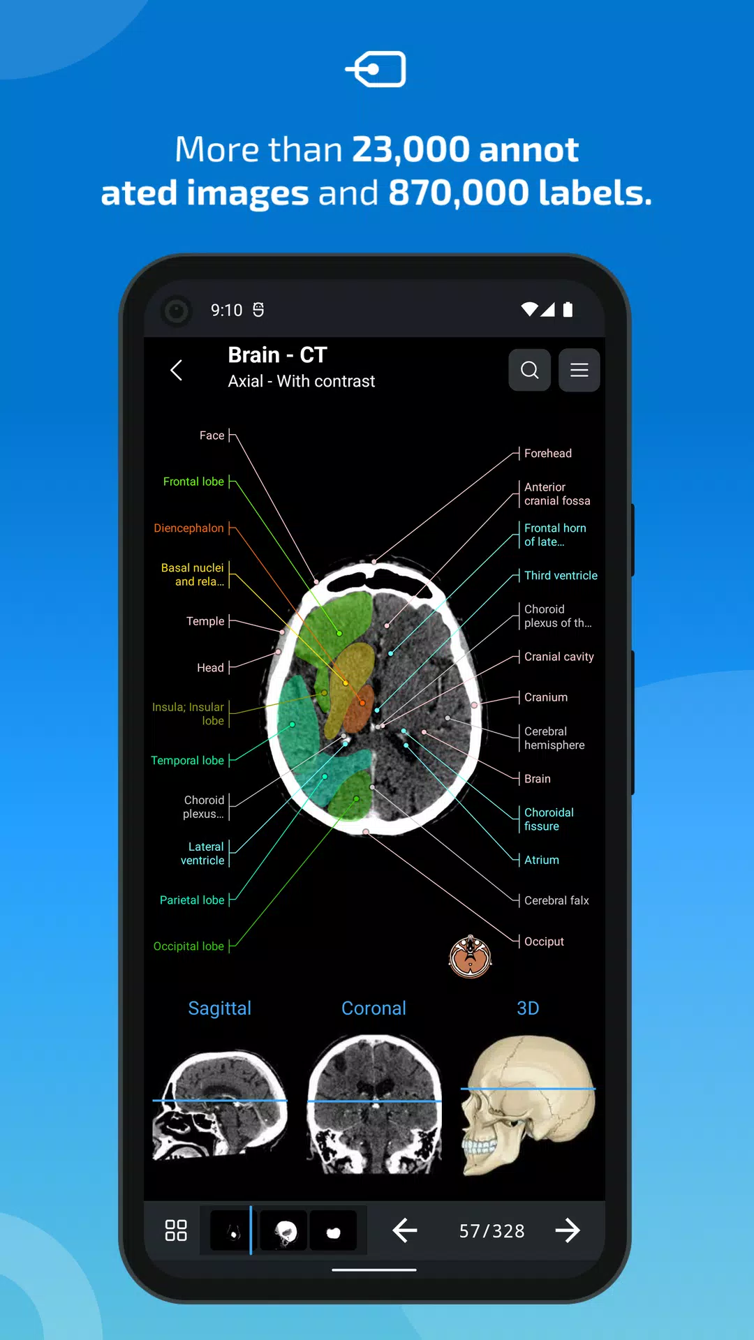 e-Anatomy Screenshot 1