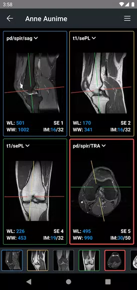 IDV - IMAIOS DICOM Viewer应用截图第2张