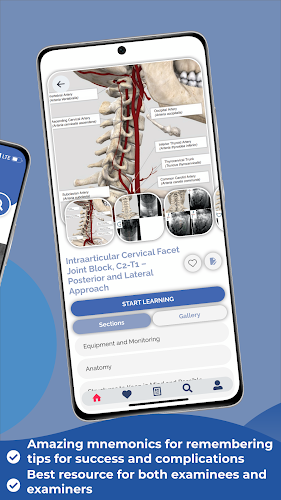 Interventional Pain App Capture d'écran 1