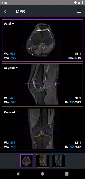 IDV - IMAIOS DICOM Viewer应用截图第3张