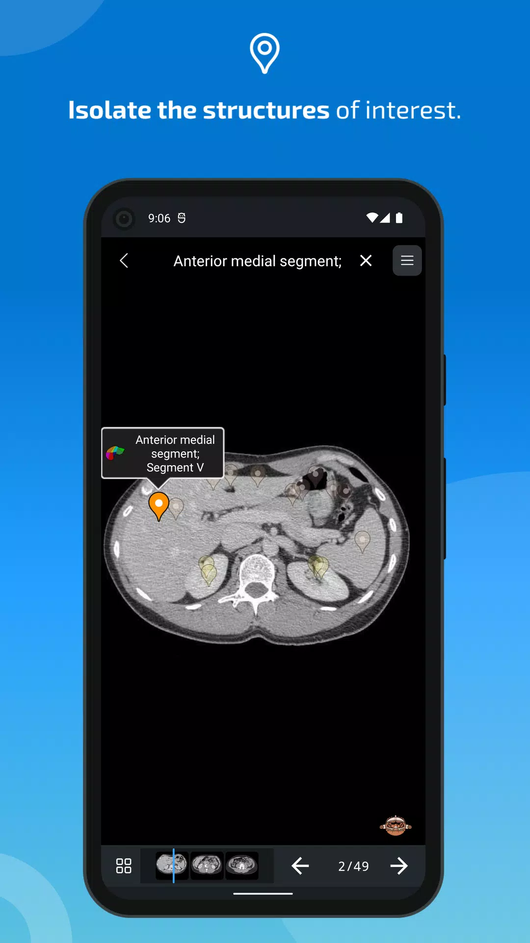 e-Anatomy ဖန်သားပြင်ဓာတ်ပုံ 3